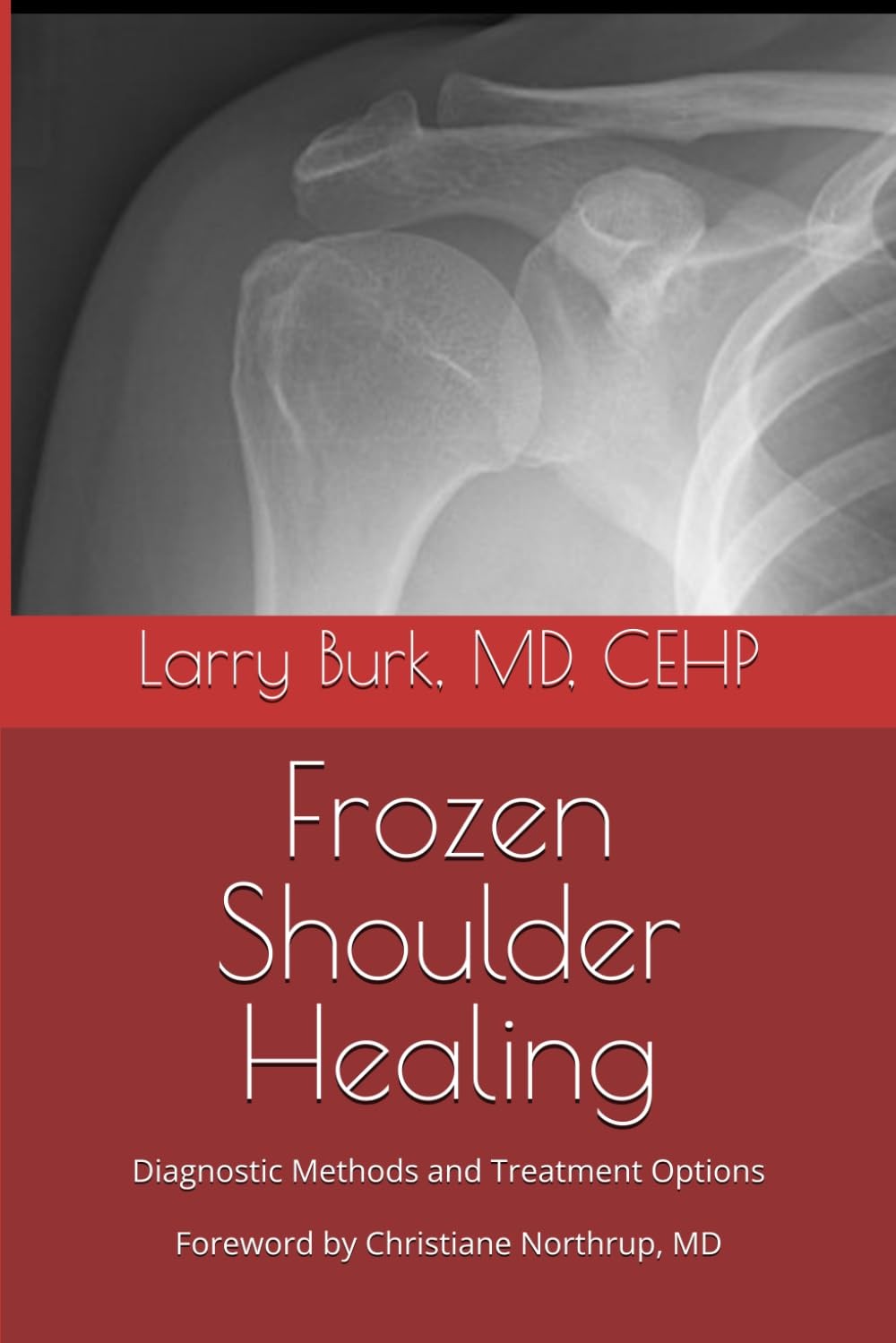 Frozen should book cover